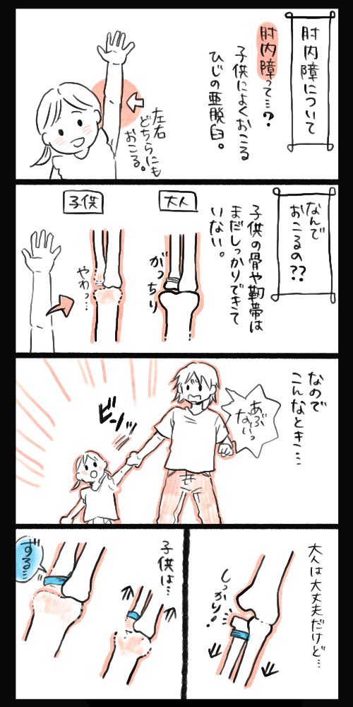 肘内障のはなし①

無計画に描いたから目線がちゃんぽん?
子供によくある肘内障。整形外科でないけど研修医のときに肘内障のお子さんよく来ていました。

#肘内障
#育児漫画 