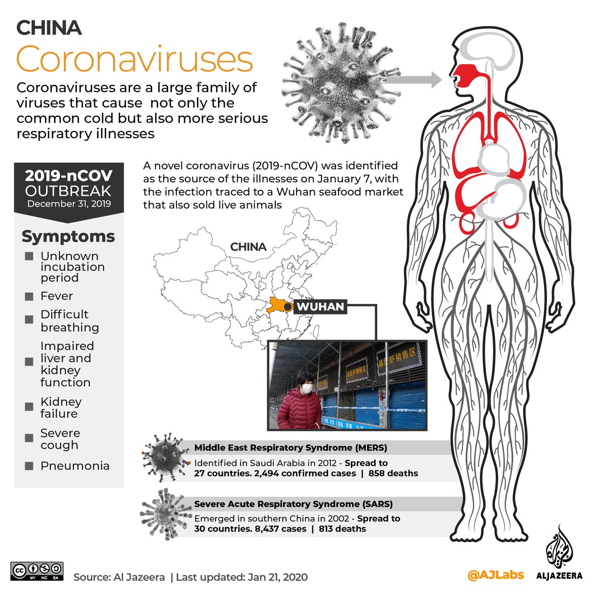 DewjiFoundation's tweet image. These viruses were originally transmitted between animals and people. Human transmission  is through air such as coughing and sneezing. Symptoms for the Novel Coronavirus include fever, cough, shortness of breath and breathing difficulties.
@AJEnglish @ajlabs #AJLabs