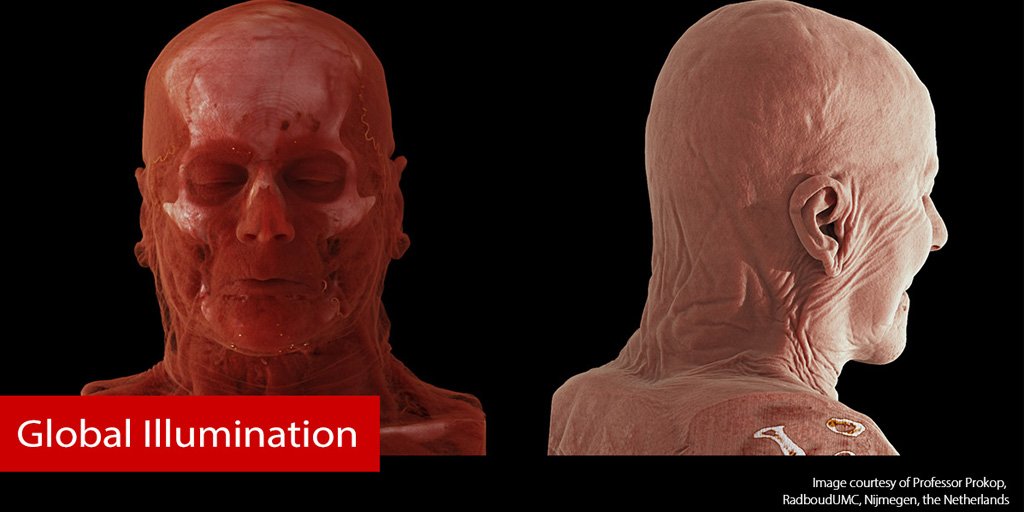 CanonMedicalEU's tweet photo. It’s like something out of a body exhibition – incredibly realistic and exceptionally detailed. #GlobalIllumination really is the new standard in advanced visualization. #MadePossible

View more: https://t.co/W9PSayQwEu 

#advancedvisualisation #photorealistic #volumerendering https://t.co/n0kfmzX9Rq