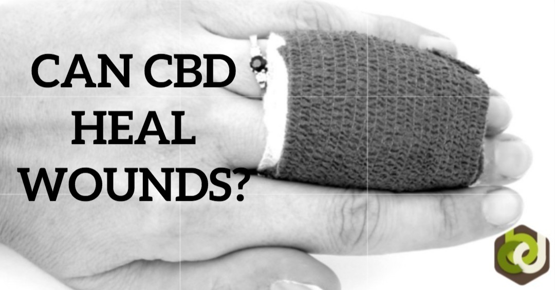 CAN CBD HEAL WOUNDS?🤔
FROM THE ARTICLE: "Results of a recently completed study found that an experimental cannabinoid-based topical medicine achieved an extraordinary 90% success rate in healing chronic wounds."⤵️
🔎
ow.ly/9Kv050y5yGN
