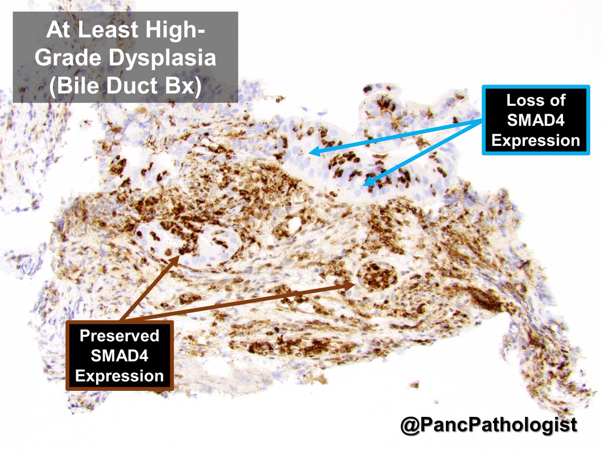 PancPathologist tweet picture