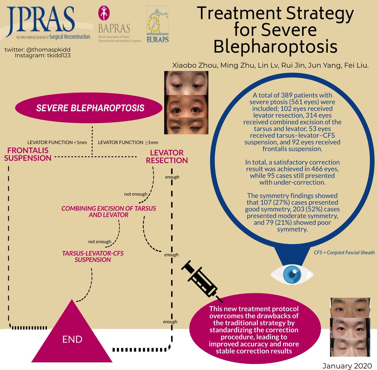 JPRASurg's tweet photo. Check out this #openaccess article in #JPRAS on #blepharoptosis 

#plasticsurgery #oculoplastics #eyelid 

https://t.co/Jqfq49C3aC

VA author: @thomaspkidd https://t.co/0hShMHX5gg