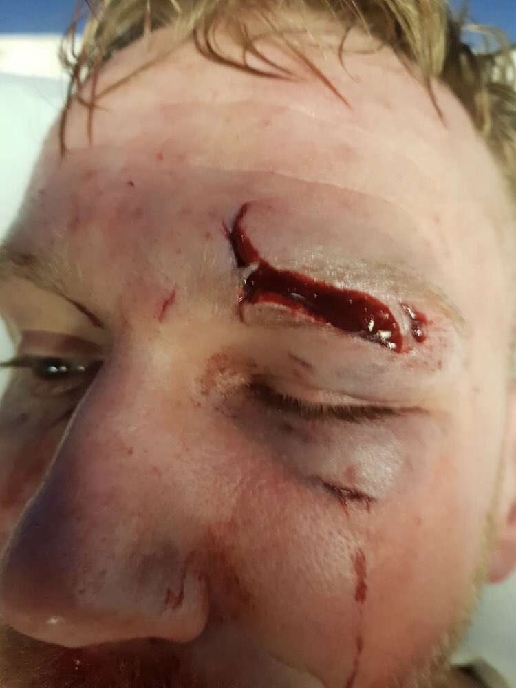 bkb_official1's tweet photo. Respect all the warriors who fought at Bkb 20 for our entertainment 👊👊👊 https://t.co/KxLpVttFpg