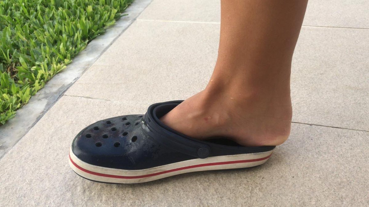 Total 30+ imagen mis crocs se encogieron