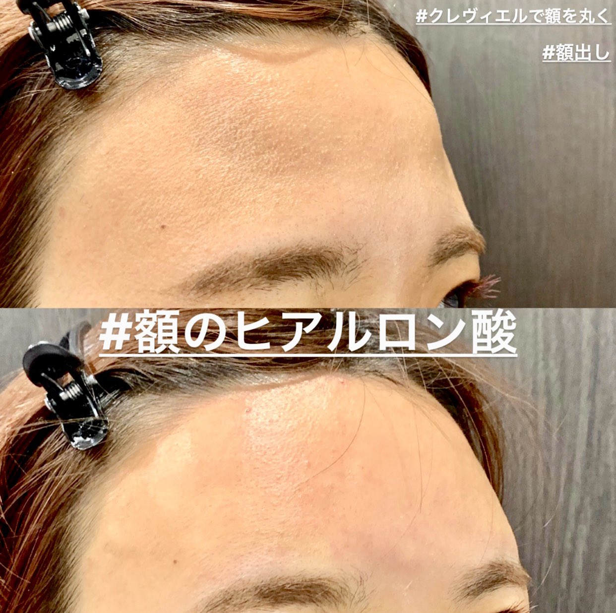 額を丸く Twitter Search Twitter