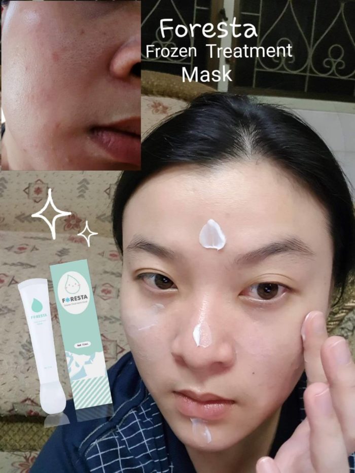 siamforesta's tweet photo. Sleeping Mask สูตรเจ้มจ้นแต่อัตราการแพ้น้อยมากๆ เพราะเราให้อาสาสมัคร 120 คน เทสก่อนวางจำหน่ายค่ะ เพื่อให้แน่ใจว่าทุกคนจะสามารถใช้ได้แบบมั่นใ����ริงๆ

ตัวนี้เน้นบูสผิวเร่งด่วน สิวแห้งยุบไว ผื่น แพ้ คัน บวม แดง หน้าลอก หน้าเป็นขุย หน้าโทรม ห้ามพลาด

❤️ 10ml. 390฿ ส่งฟรี EMS ค่า https://t.co/DAUMbNCojR