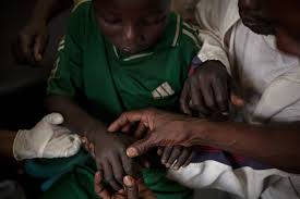 arntd_org's tweet photo. According to a study done in 2006, #snakebites cause at least 20,000 deaths and at least 421,000 people experience snakebites. However, these figures may be as high as 1,841,000 and 94,000 deaths due to limited data. #beatNTDs  #BeatSnakebite #WorldNTDDay https://t.co/hCv1Wklrar