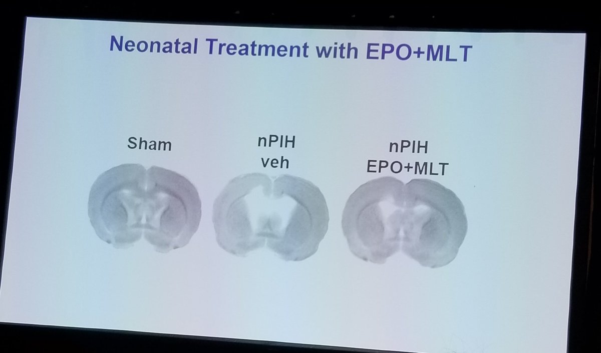 aflannery516's tweet photo. #ASPN2020
Dodie Robinson treating post infectious hydro with Melatonin and erythropoietin #inrats. Human studies to come https://t.co/bDyTI1plqa