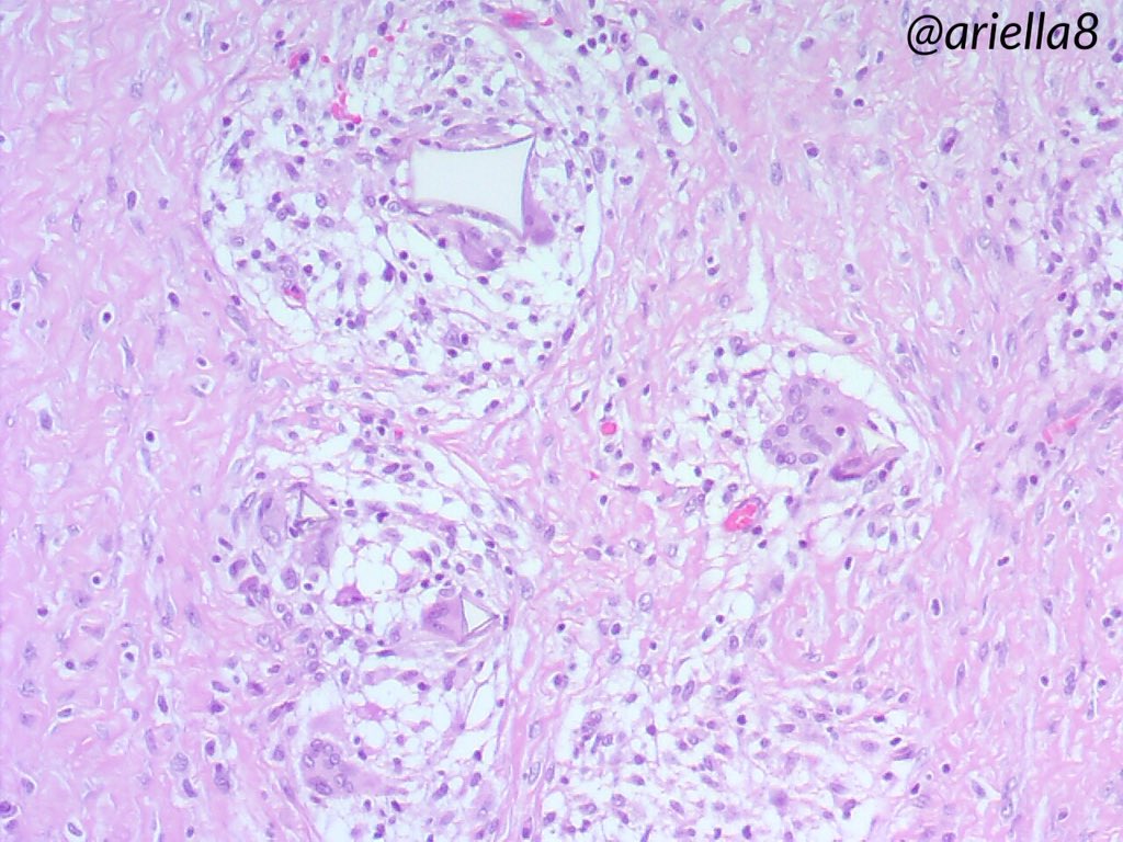 ariella8's tweet photo. #Pathpuzzler #Pathcasetosolve #Pathology #Medicalforeignbodies #infectiousdiseases As promised here are more pics ,you got some clues already if you want some additional info you can ask one question,to know where we are 😁 https://t.co/iscljJhmkH