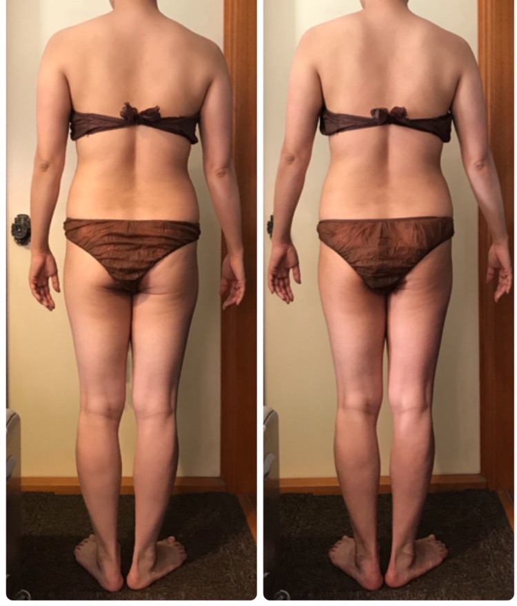 増強 フラグラント めまい セルライト ボコボコ Hamakyu Jp