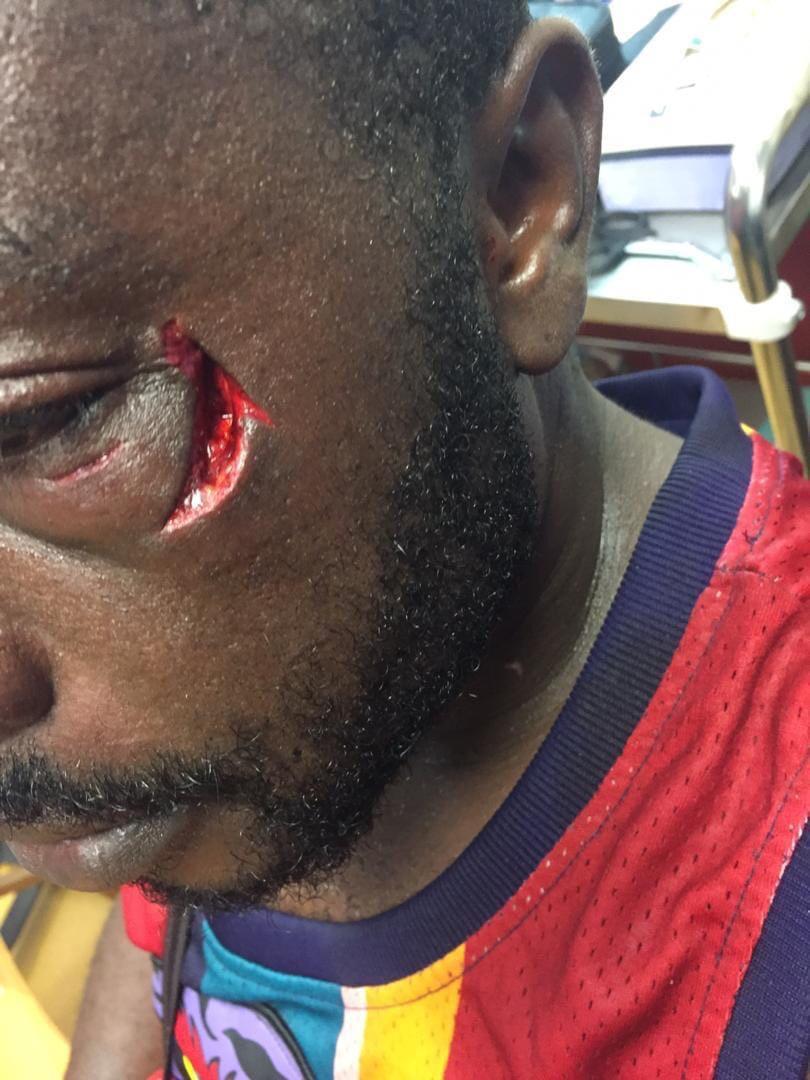 HAPPY989FM's tweet photo. I was jubilating Kotoko's victory so I was running around rejoicing. When I got where he (Patrick) was, he asked me to get out from there - Michael Siaw, Kotoko supporter who was beaten up by Patrick Allotey, a professional boxer
#HappySports https://t.co/0yzSIxkf1T