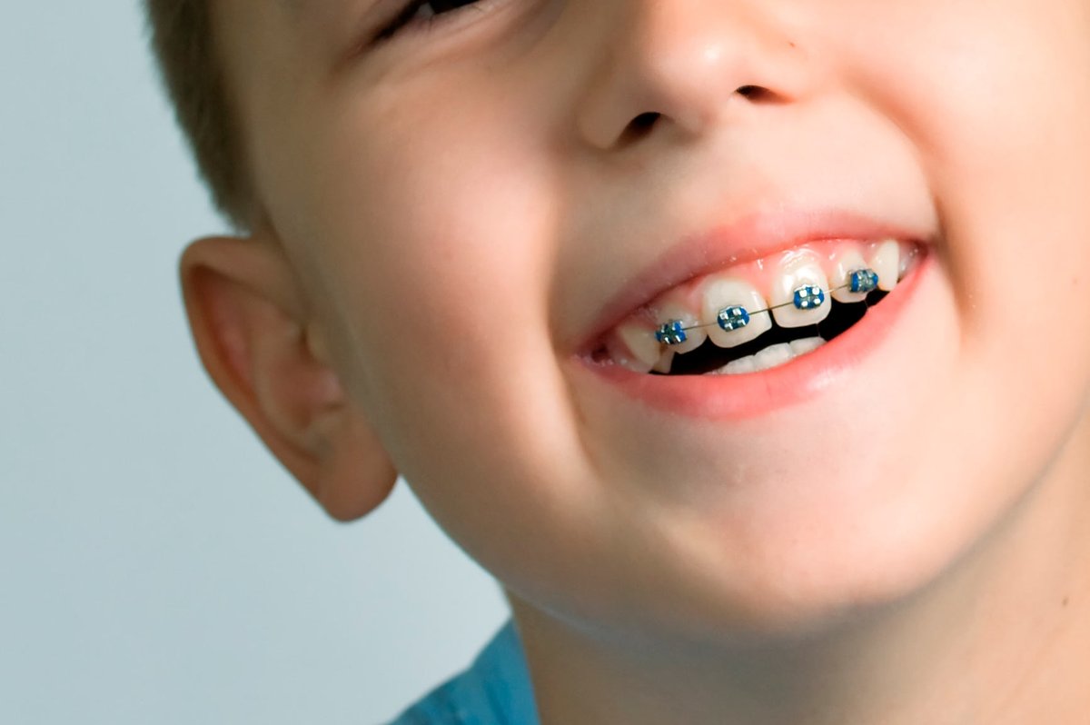 DentalAlmar's tweet photo. Clínica de ortodoncia infantil Valencia:

https://t.co/3K0tEvVCmL https://t.co/sZyyzlHbg5