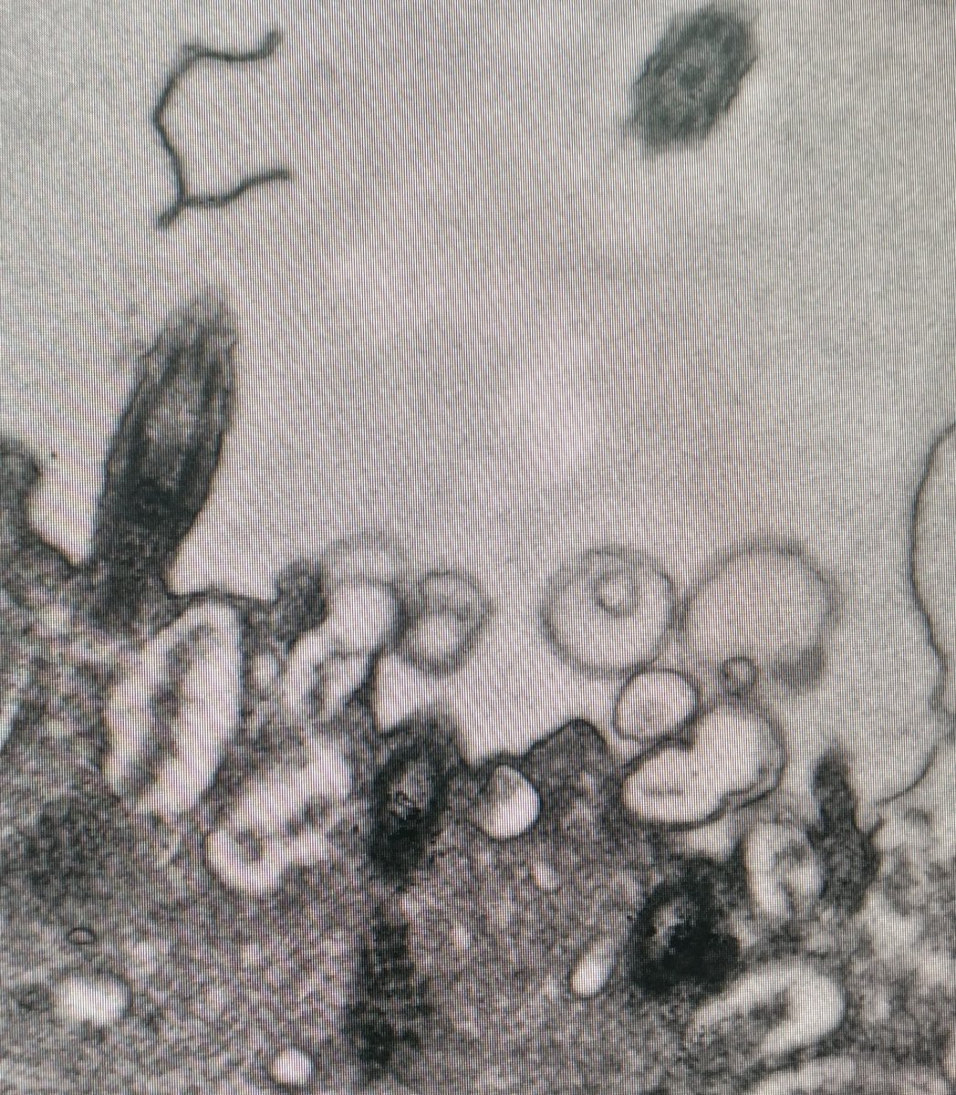 WalentekLab's tweet photo. The @WalentekLab loves #cilia! Here you see a TEM section though a #xenopus #multiciliatedcell https://t.co/YucxFctbMr