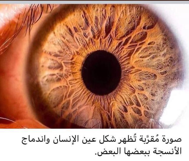 Зеленый зрачок. Желтые зрачки. Сурен манвелян глаза человека. Глаз под микроскопом. Зрачок представляет собой.