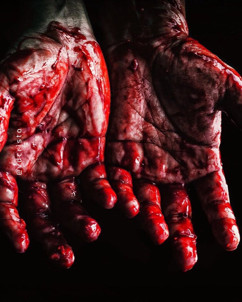 vd_cristo's tweet photo. Se você não se curar do que te feriu, você vai sempre sangrar em cima das pessoas que não te cortaram. 

Considero que os nossos sofrimentos atuais não podem ser comparados com a glória que em nós será revelada. Romanos 8:18

// Thiago Barboza https://t.co/dDBomxookJ