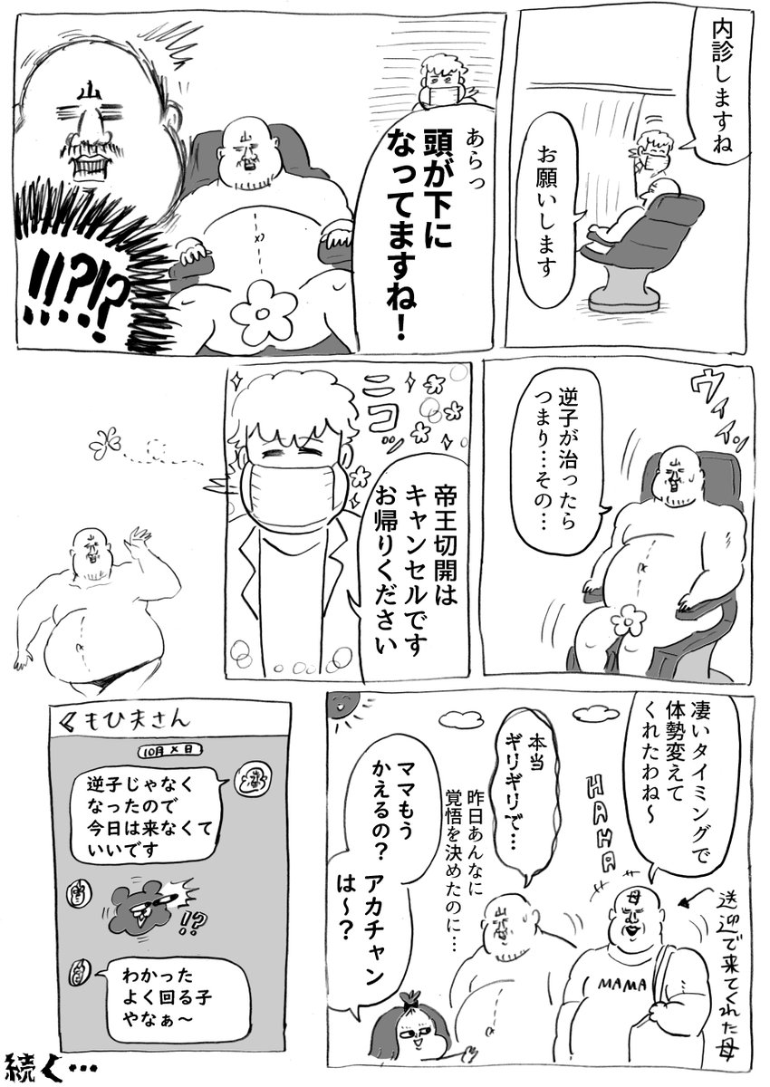 第二子出産レポその2～逆子・第二章～ (漫画3P) 