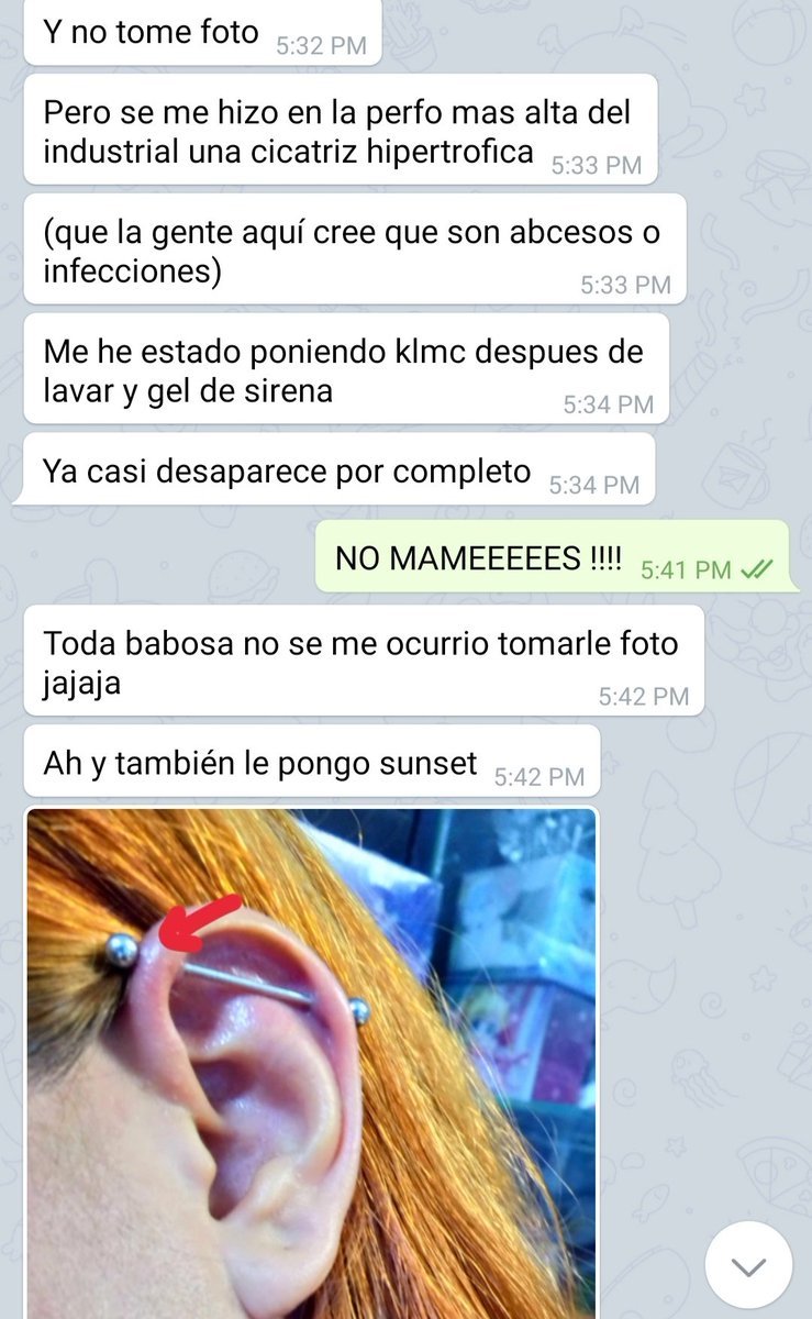 aracelideanda's tweet photo. #MartesDeReseñas #MenjurjesChingones
Cicatrización exprés con #KLMC https://t.co/MaHIn1IzL0