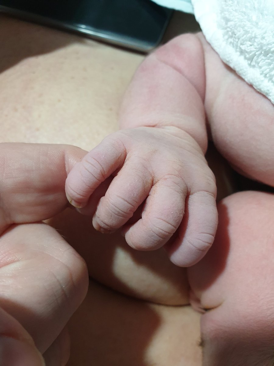 So my daughter arrived this morning. Mother and baby doing really well and im just totally in love.  Here she is holding Daddy's hand ♥️