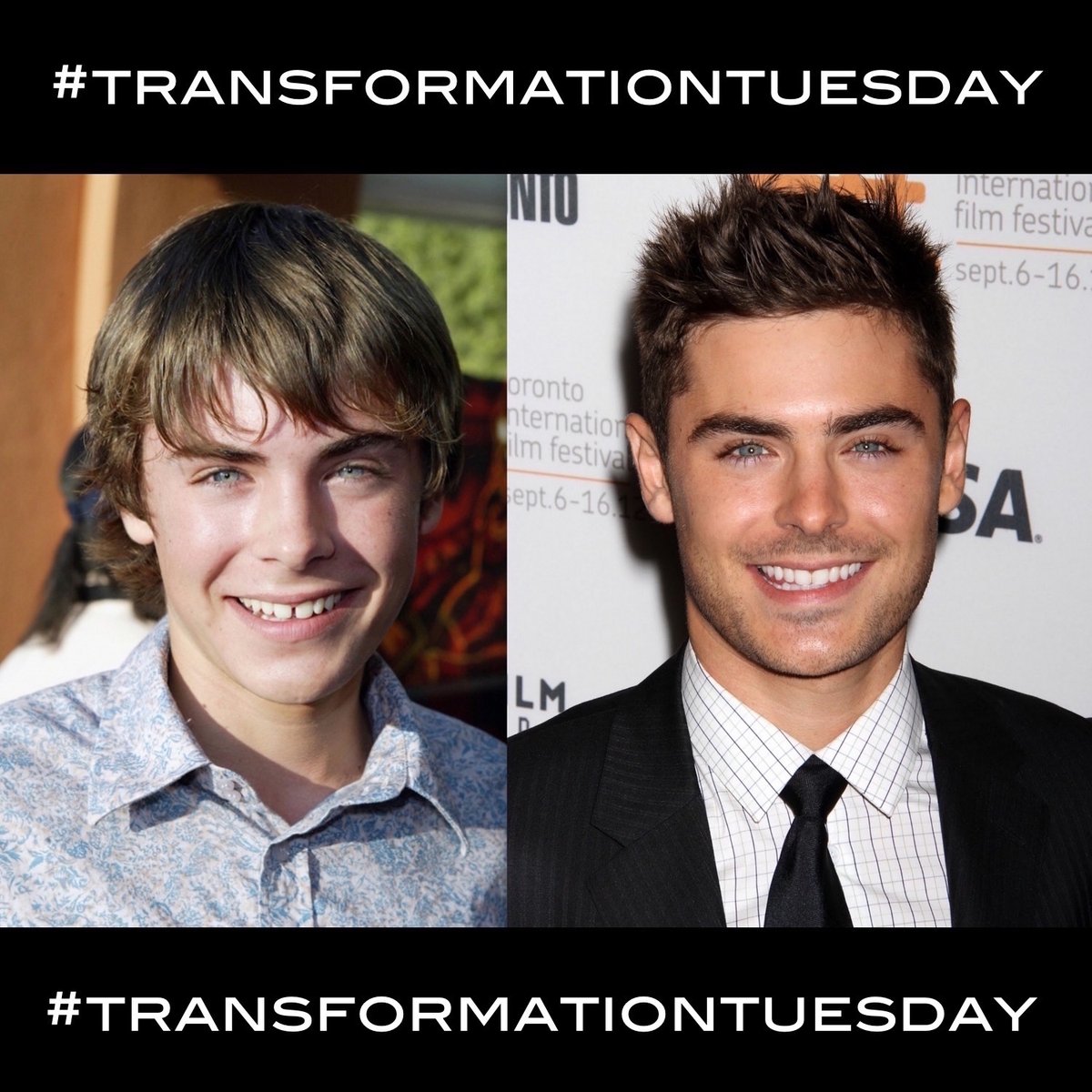 BellflowerGroup's tweet photo. If you're looking for ways to enhance your #smile and feel more confident, you're not alone! #transformationtuesday

https://t.co/W8UUUl1wdR https://t.co/cT0iJjXaQT