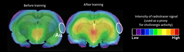 'Au' is the auditory cortex, a part of the brain that identifies sounds. The scan shows more activity in this part of the brain after training to differentiate between sounds