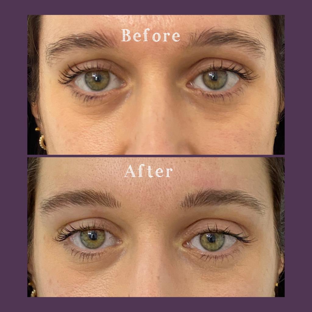 raedenman_'s tweet photo. Using a warm colour in the brows with Permanent Makeup drawing attention to the eyes. Donβt you think they look a brighter green? π #srbrows by @raedenman_
#permanentbrows #naturalbrows #permanentmakeupartist #browsbrowsbrows #browspecialist #surreybrows #londonbrows https://t.co/KVpMKRZelb