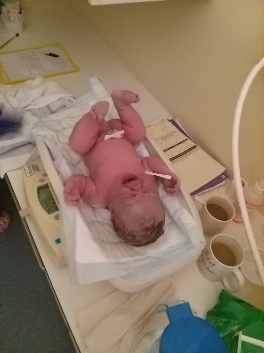 UGMAN86's tweet photo. Shes a whopper! Thea born 4.40am weighing in at 10lb2. #dadagain https://t.co/ngmlymvBfo