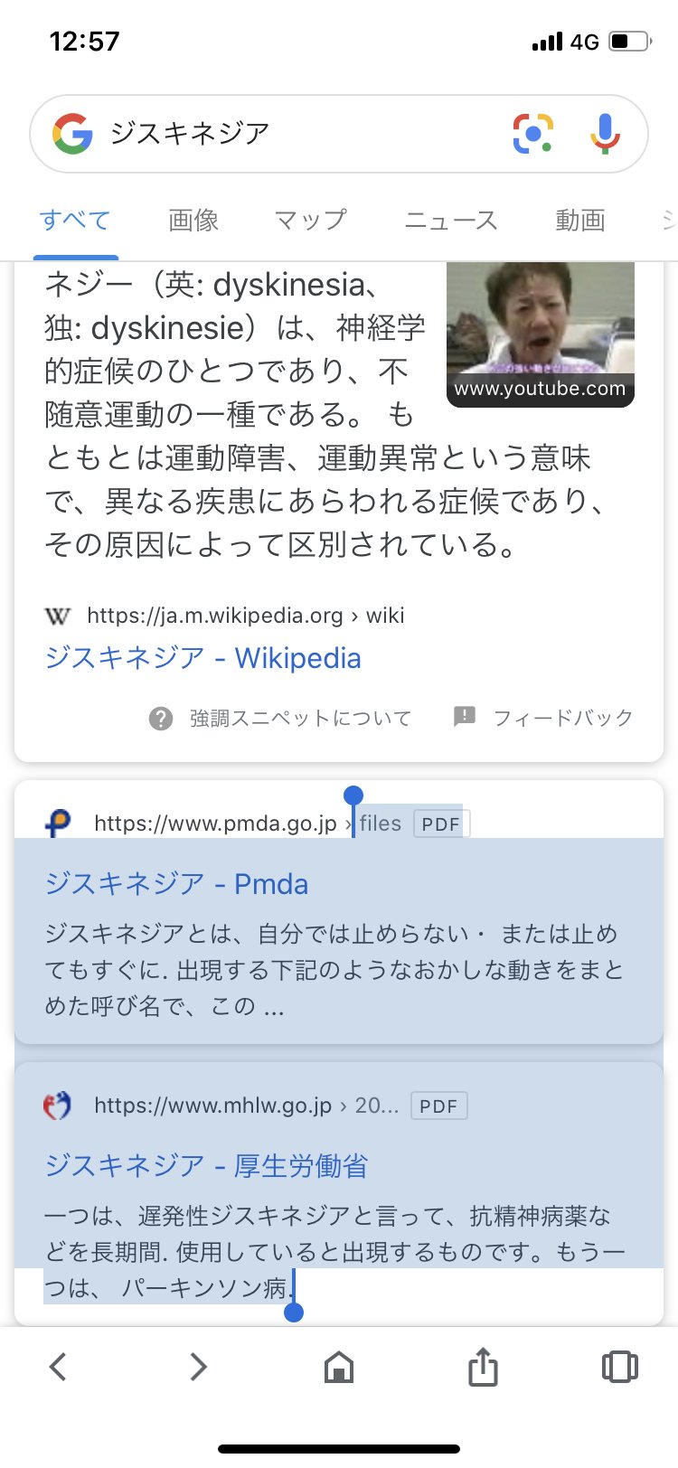野村俊一 患者様の声 精神科入院中の重度 ジスキネジア T Co Bjcvq04i16 患者さんの神経内科専門医への紹介 紹介をしてくれず悪化も 連携をしてくれません ボツリヌス療法 T Co S4iwtxy0zz T Co Urbqobzswu を精神科の先生に広げ