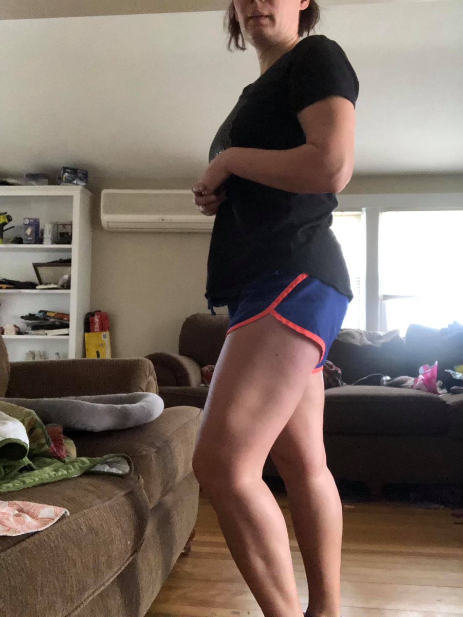 DeepRelief's tweet image. My leg definition is a work in progress 💪 I have a concave IT band on my left side from being kick by a horse 🐎 heavy squats and deadlifts have actually reduced the scaring the most out of everything I’ve done over the years to heal this injury.