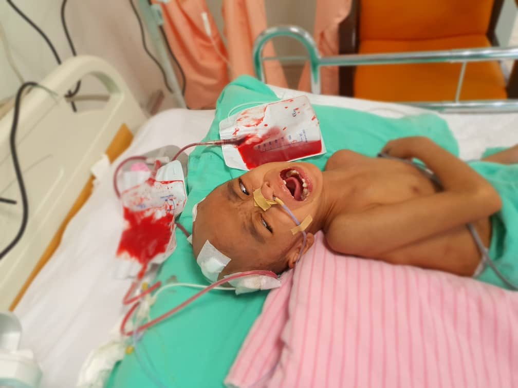 fedtriyahya's tweet photo. Boleh bantu derita adik Fawwaz? Tertimpa peti ais 1.8 Meter. Ibu bapa hanya berniaga air balang di Nilai. Kini fokus menjaga anak mereka di hospital. No akaun untuk sumbangan: 

No akaun maybank
562263547454 Mohd Bukhari https://t.co/VuCPyxhVG0