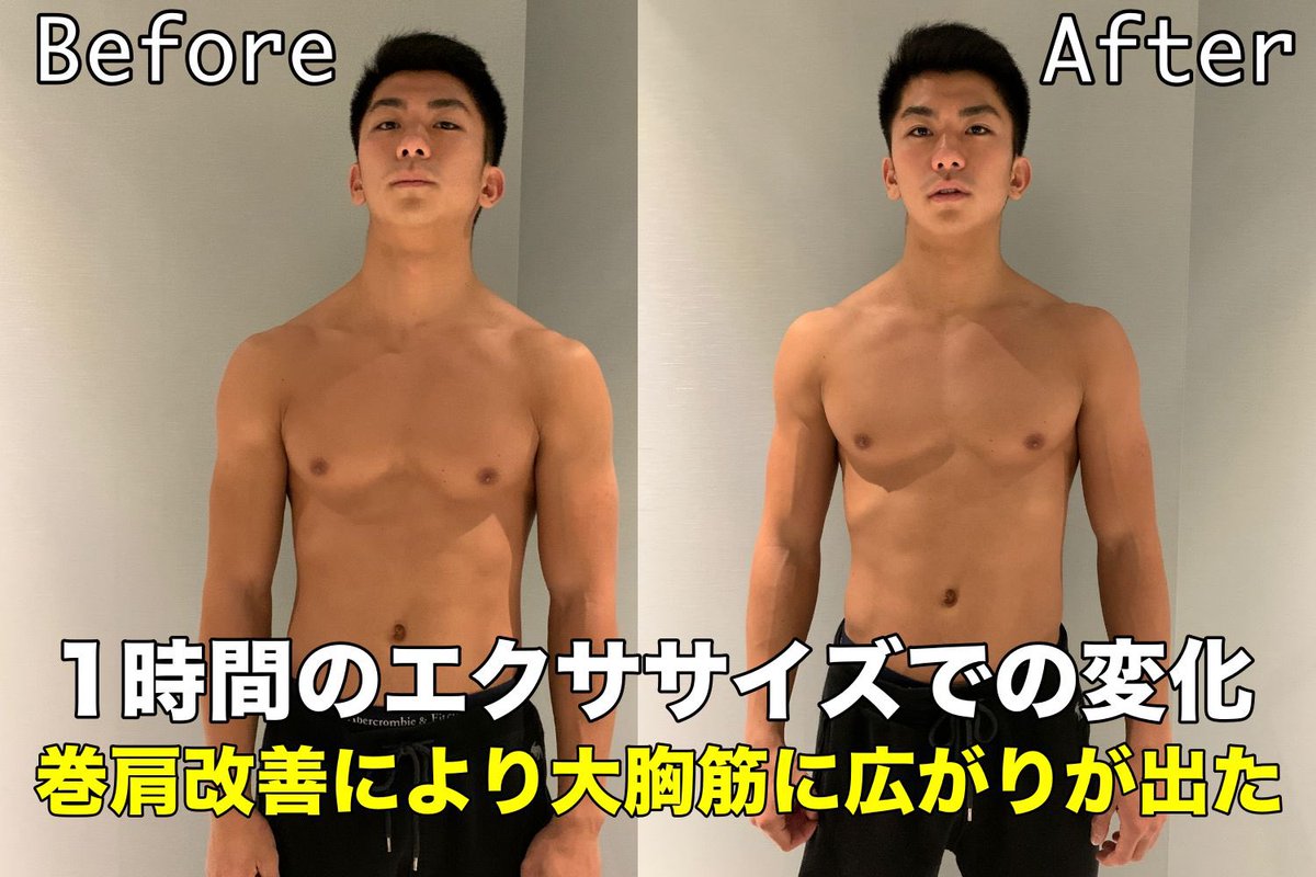 オカザーマン Youtube登録4万人 60分間パーソナルビフォーアフター 巻肩が改善したことで 大胸筋の形がひろがりました 女性はバストアップに繋がります 怪我の防止 停滞期打破 筋肥大効率up など効果はたくさん 姿勢改善後のトレーニングは より オカザーマン Youtube登録4万人 60分間パーソナルビフォーアフター 巻肩が改善したことで 大胸筋の形がひろがりました 女性はバストアップに繋がります 怪我の防止 停滞期打破 筋肥大効率up など効果はたくさん 姿勢改善後のトレーニングは より