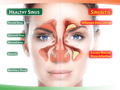VumaFM's tweet photo. Stand by for #TheDoctorsRoom on #TillNoon with @VanessaMarawa @SihleMvundla  @ 10:20am-11:00am talking about sinusitis and Tonsillitis with Dr Bonga Gwala @bongaGee he will unpack how we can treat these illnesses @kznhealth @HealthZA https://t.co/ONxFUT4uiP