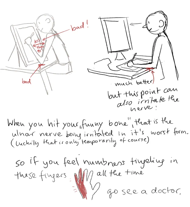 @applestrudelz @kipkune have a horrible drawing of mine, that hopefully explains it somewhat. the nerve can also be irritated by your sleeping position. (second image) 
