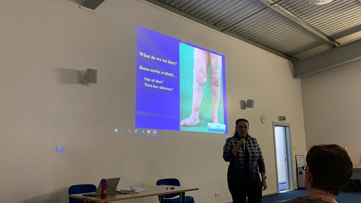 mamdadboys's tweet photo. Professor Rhoda MacKenzie discussing the benefits of exercise. #legsmatter #lowerlimbstudyday #woundadvocate @katetvn @NHSGrampian @KristineDuguid @HSCAberdeen @KarenSi38055850 @scstring @FRuss247 https://t.co/yNXot4ZiXm