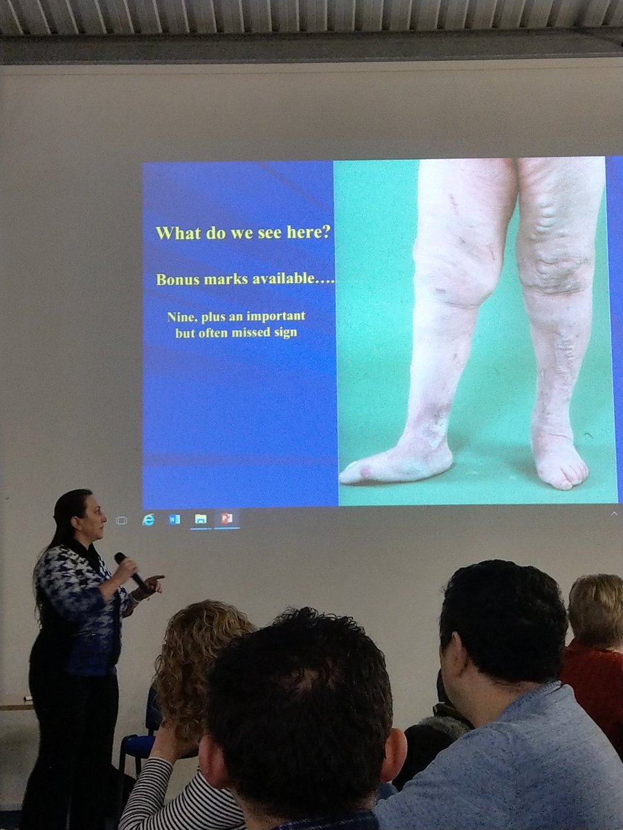 K4renSimpson's tweet photo. #lowerlimbstudyday
Fascinating talk about exercise as therapy in chronic vein ulcers from professor Rhoda MacKenzie. https://t.co/U4O0sGNK5K