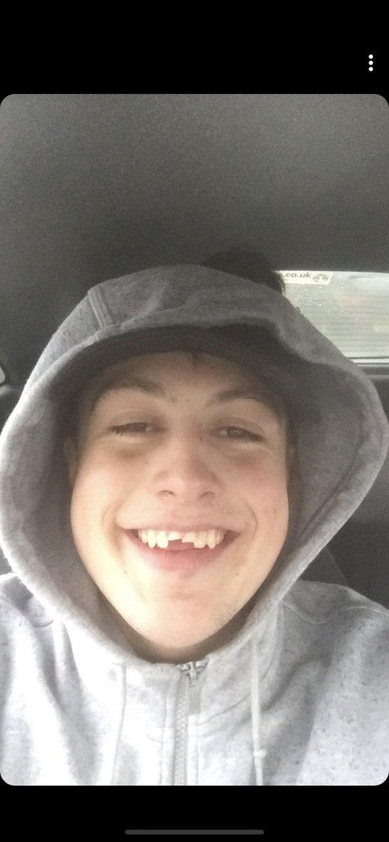 Scrivs Tooth tweet media