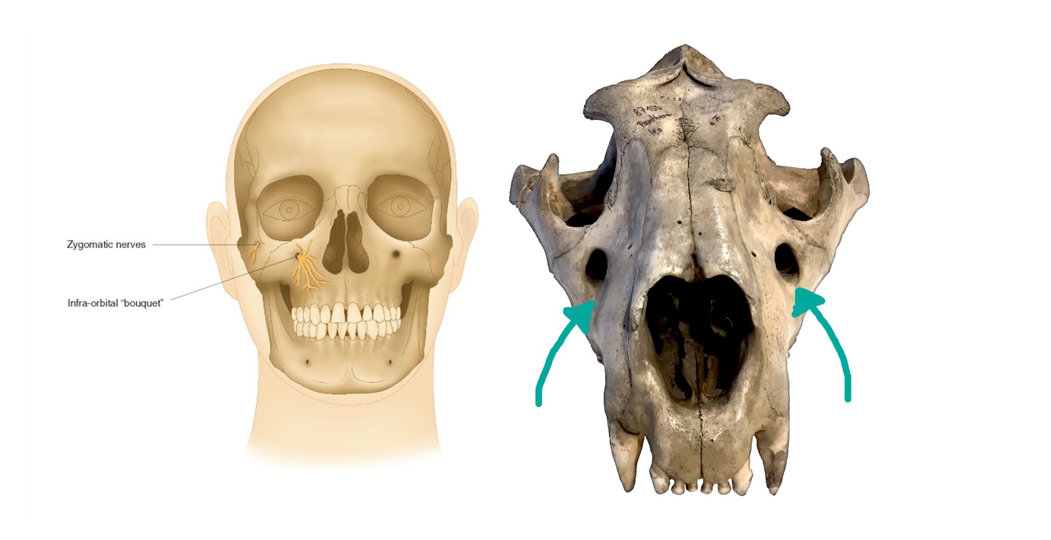Y A R A • يارا • Hectic Skeleton On Twitter: &quot;Check Out Those Massive Infraorbital  Foramen, Humans Have Them As Well. Can We All Agree “Bouquet” Is An  Upsetting Term In