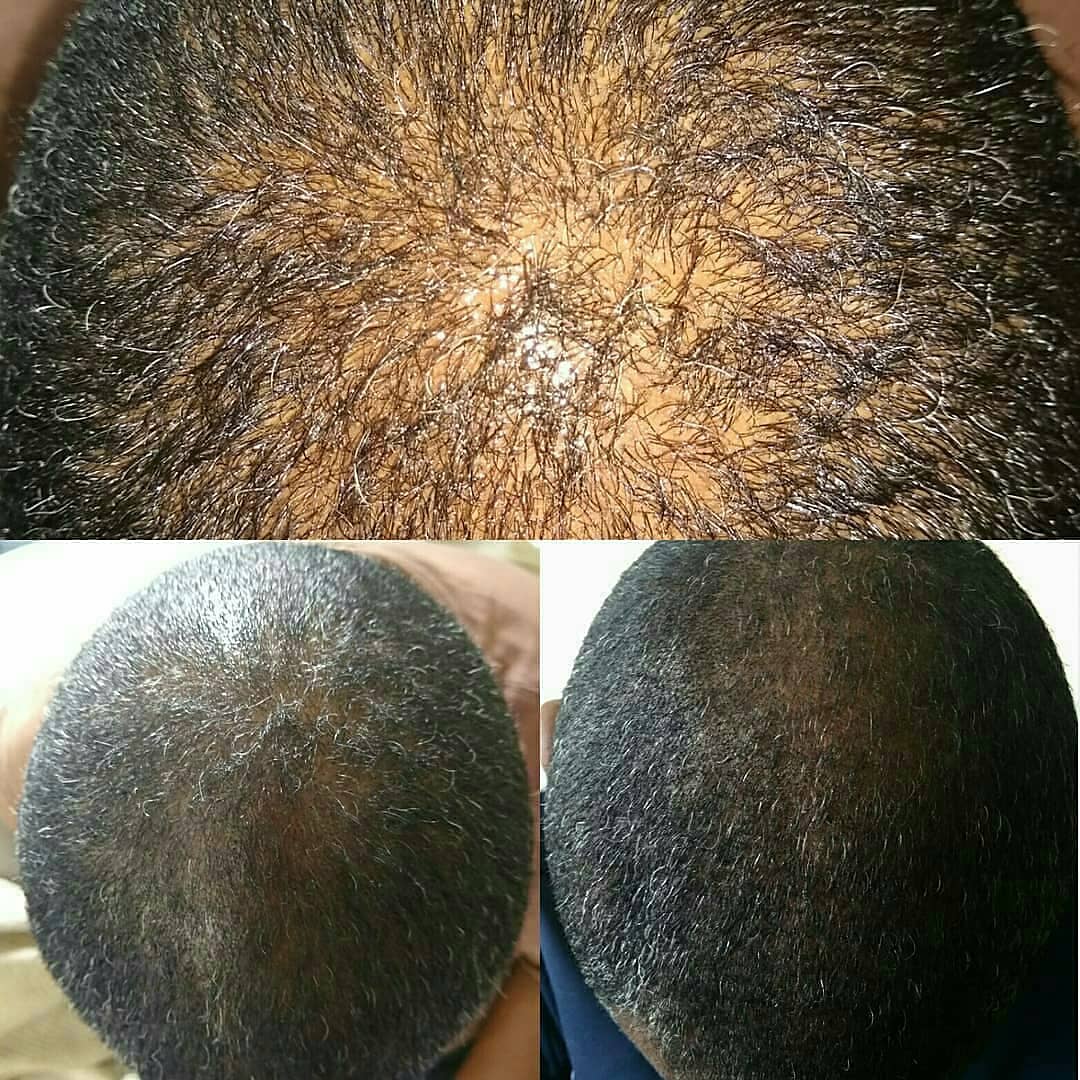 EdensLegends's tweet photo. Afro-Nutritious with Jamaican Black Castor Oil & Ylang-Ylang Oil, Rosemary Oil - designed to promote #hairgrowth #hairrepair #damagedhair #recedinghair #handmade #organic #vegan #plantbased #afrohair #moisturizing #nutritious https://t.co/MtOZnhWsYB