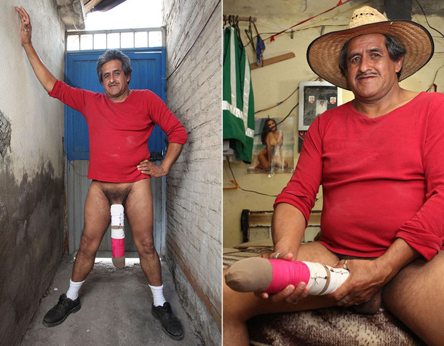 Man With World's Longest Penis Poses In Skin