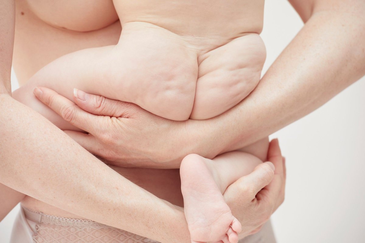 The Lines Love Left Behind, a new project from Emma Tunbridge
See more of Emma’s work on our site: 
ow.ly/DkWp50y7RJr
#motherandbaby #postpartum #women #beauty #skin #photography #studio #emmatunbridge #terrimanduca #baby #beauty