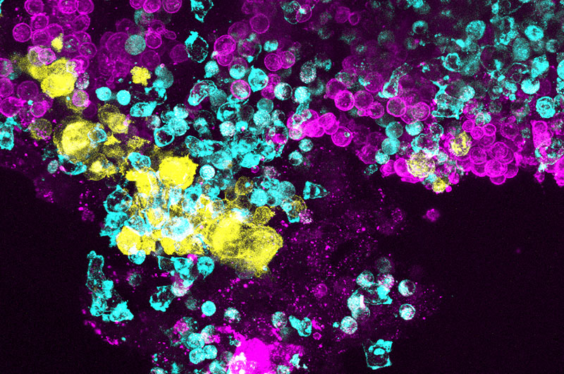 This immunofluorescent image shows the multiple cell types that develop within the human bone marrow chip. Magenta: erythroid cells, yellow: megakaryocytes, blue: other hematopoietic cells. (Wyss Institute at Harvard University)