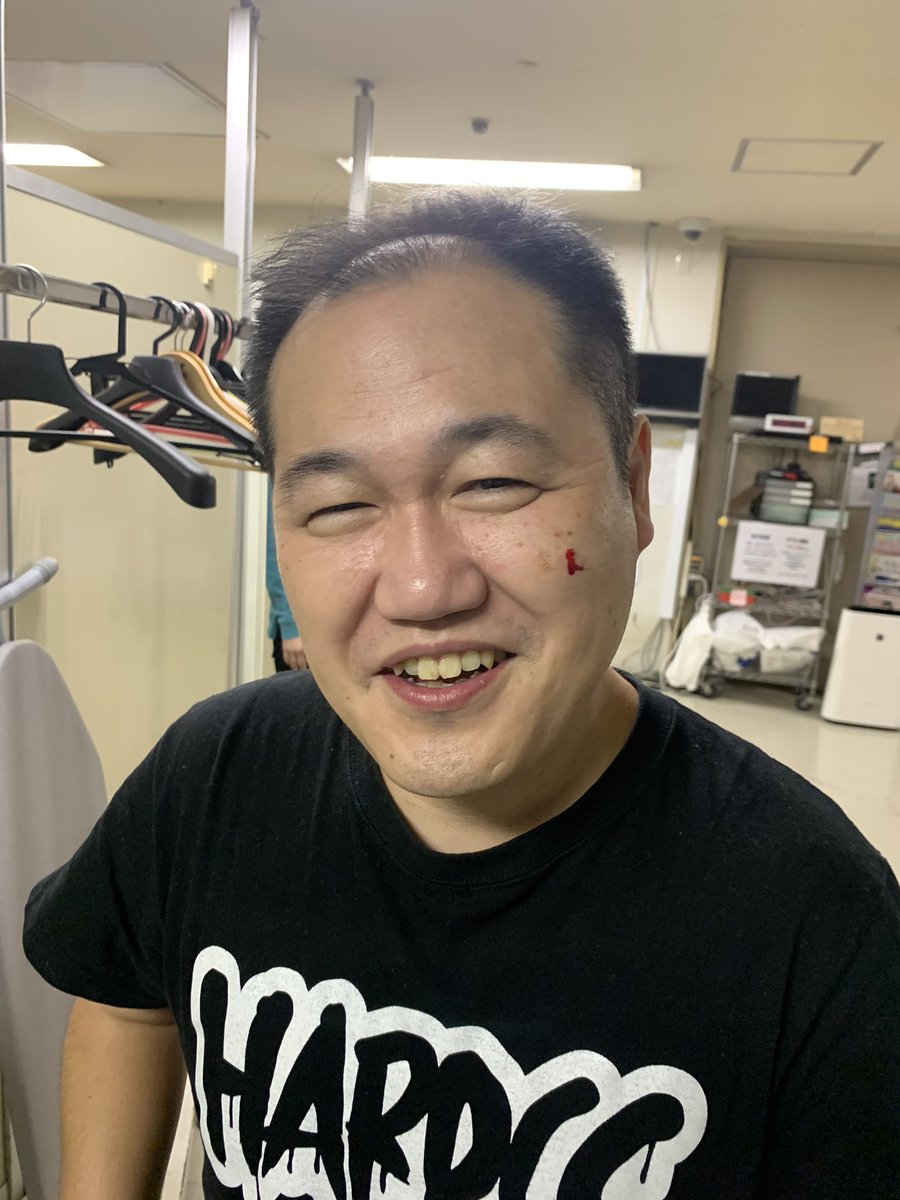 Twitter पर すゑひろがりず南條 マイルド軍団ライブありがとうございました ルミネで満員御礼札止めとはやんごとなし 楽屋打ち上げにて ほっぺたのかさぶた剥がして血が止まらない総統 赤い血が流れてて良かったです Twitter पर すゑひろがりず南條 マイルド軍団ライブありがとうございました ルミネで満員御礼札止めとはやんごとなし 楽屋打ち上げにて ほっぺたのかさぶた剥がして血が止まらない総統 赤い血が流れてて良かったです