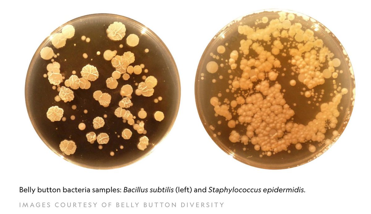 AndrewsInst_TCU's tweet photo. On average, our belly buttons host about 67 different species of bacteria! #ScienceFactWednesday #Bacillus #Staphylococcus https://t.co/3mi3FI3llm