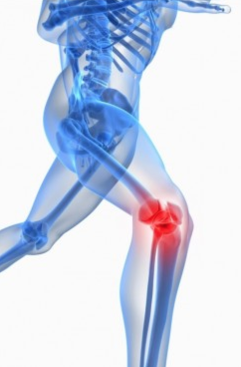 Here’s what you should know before scheduling #kneereplacement surgery. medilink.us/7bod 

A study showed the vast majority of patients who need knee replacements wait too long to undergo surgery. #sportsmedicine #sportphysician #orthopedicspecialist  #kneespecialist