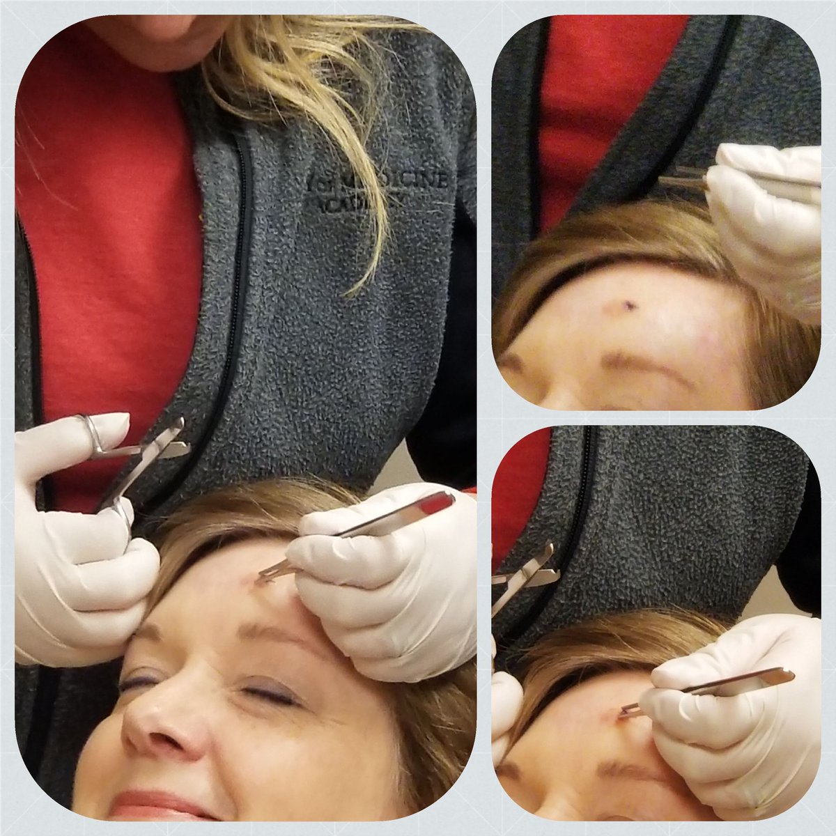 DrRenitaG's tweet photo. Advantages of being a Health Science school~ Teacher/Nurse @FON_CMA shares another skill- suture removal! It's our pleasure to serve you @ChemCma! #allinadayswork @LJackieT #WeAreDPS https://t.co/w26gp6k3Gu