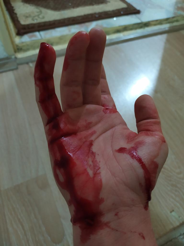 Sinir mi çok sakin biriyim aslında 👌