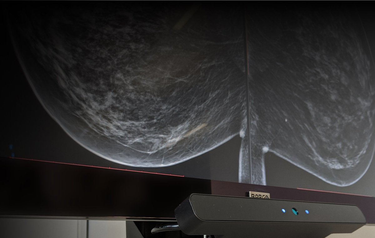 ClearVoxel Imaging tweet media