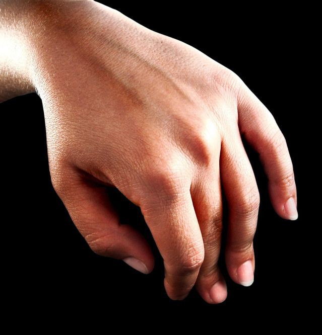 Often it's our hands that reveal our trues age. See what can be done about this - hand rejuvenation with chemical peels &amp;amp; Dracula PRP Therapy.

buff.ly/345deRq

#prp #antiageing #drdanielsister