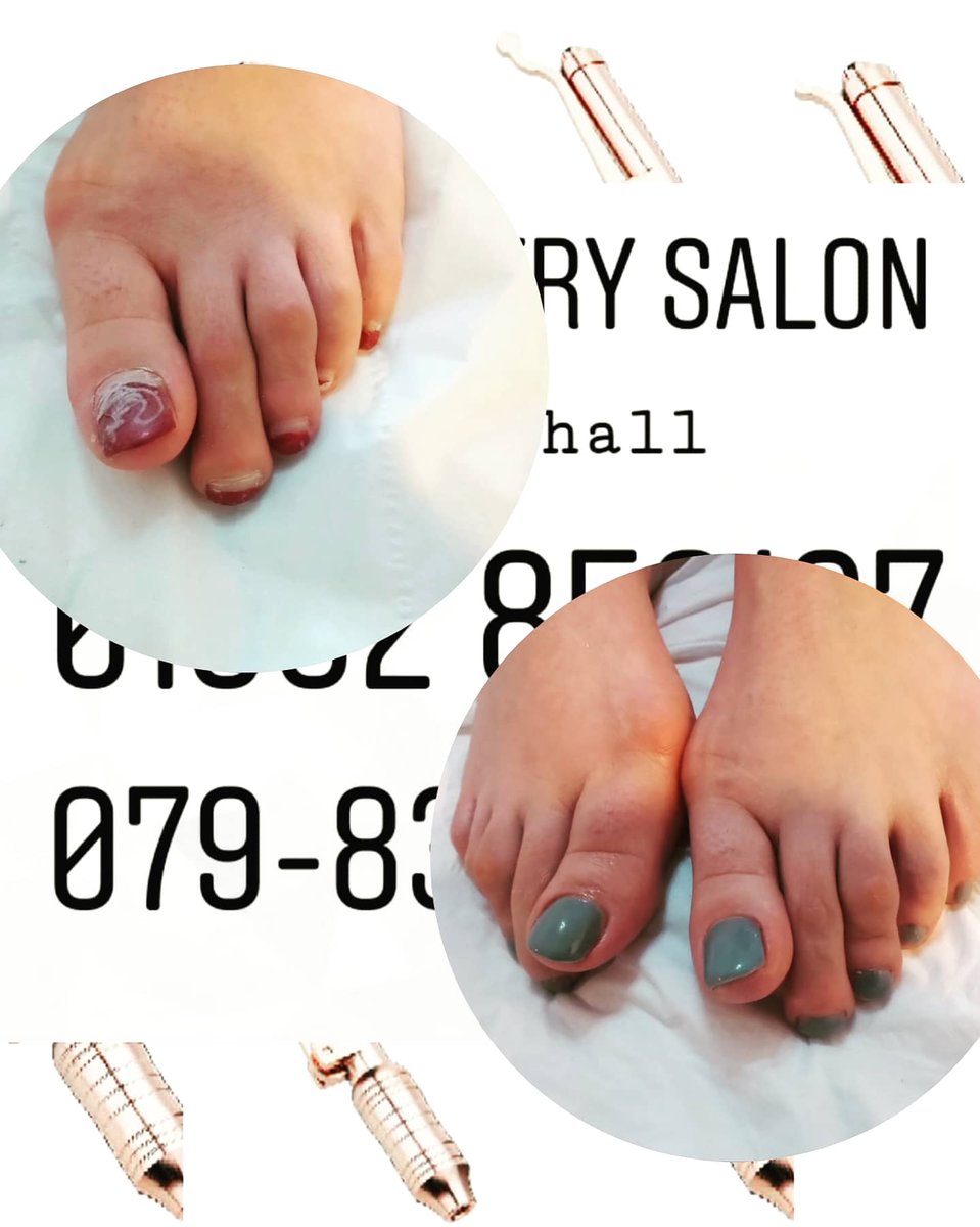 moorebag22's tweet photo. 🌟 Peels 🌟 Facials 🌟 Microneedling 🌟 Tinting 🌟 Waxing 🌟 No Needle lip fillers 🌟 Massage 🌟 Eyelashes extensions 🌟 Fat Dissolving treatments 🌟 Bio-Remodeling 🌟 Vitamin Boost 🌟 Gel Manicure 🌟 Luxury Pedicures 🌟 Neal's Yard products @thecountrysalon https://t.co/U2YFXqdeG0