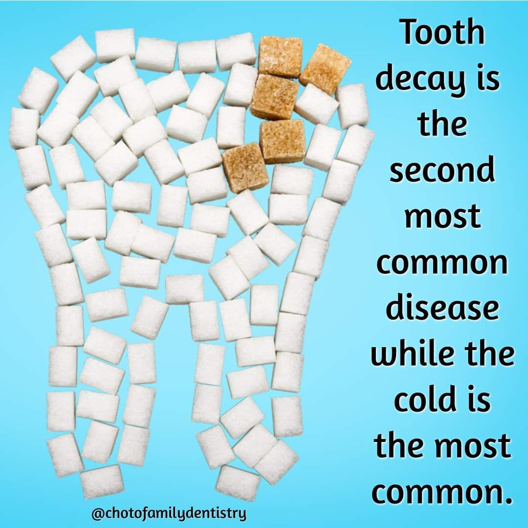 ChotoFamily's tweet photo. Did you know? Tooth decay is more common than catching a cold! 🤧 🦷 

#oralhealth #oralhealthtips #oralhygiene #knoxvilledentists #dentalofficeknoxville https://t.co/YwevBgwMh3