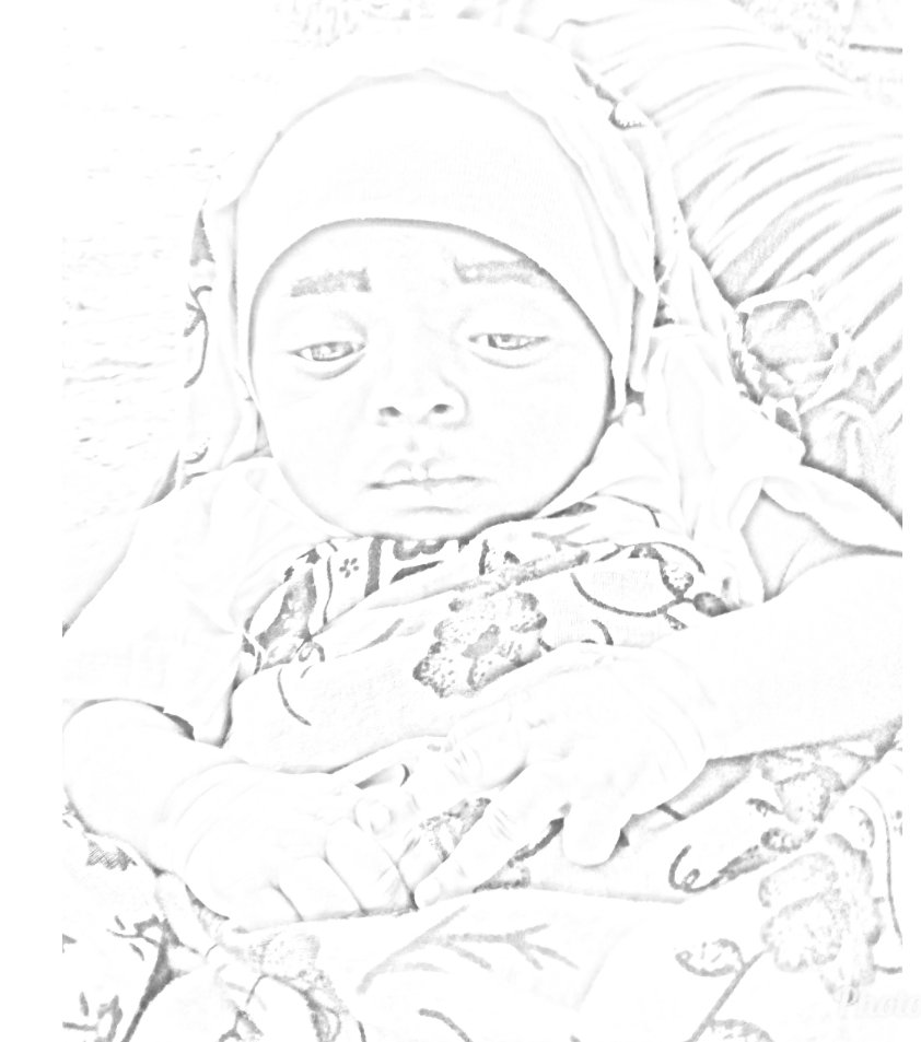 mobakha's tweet photo. Tumuombeni dua mwanangu wa miezi mitano yuko ICU tangu jana Allah amfanyie sahali afya yake. Aamin @abdulazackabdul  @Mkuruzenzi @mkandamizaji @Kingkidyy @abdulazackabdul @MarekaMalili @LusakoWaKwanza @Msumari9 @Kingkidyy @dottoimeli @GloryPeter2017 @jaliluzaid @bajabiri https://t.co/Rcp7QadI1Y